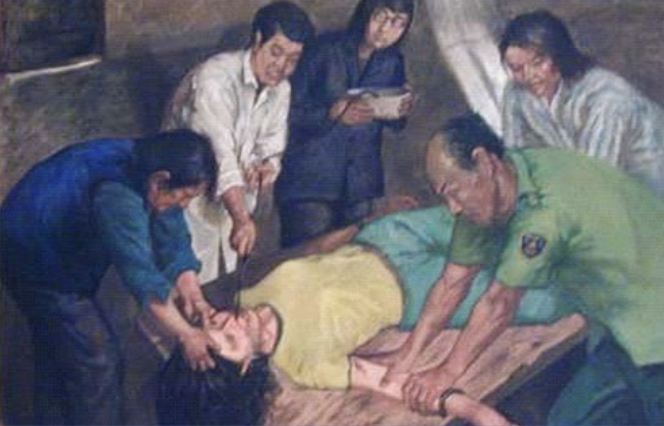 Image for article Schneidezahn abgebrochen: So brutal geht man in Chinas Gefängnissen bei einer Zwangsernährung vor
